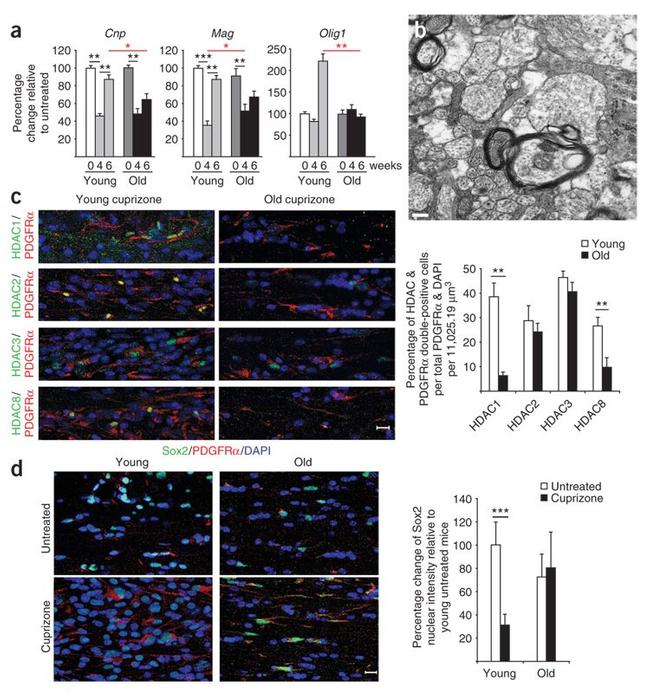 HDAC1 Antibody in Immunohistochemistry (IHC)