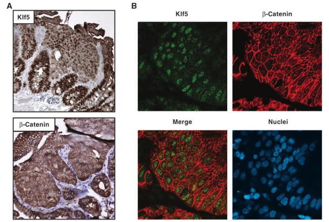 beta Catenin Antibody in Immunocytochemistry (ICC/IF)