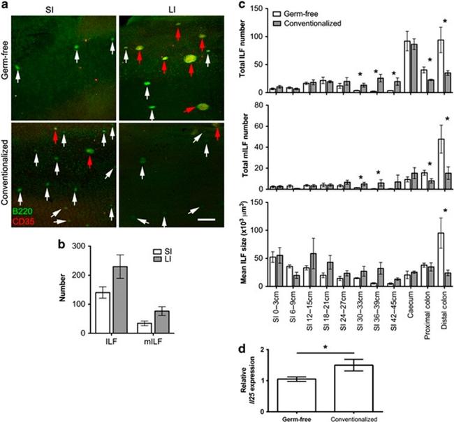 CD45R Antibody in Immunohistochemistry (IHC)