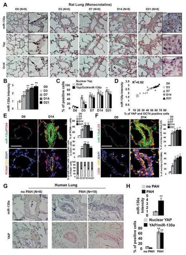 PCNA Antibody in Immunohistochemistry (IHC)