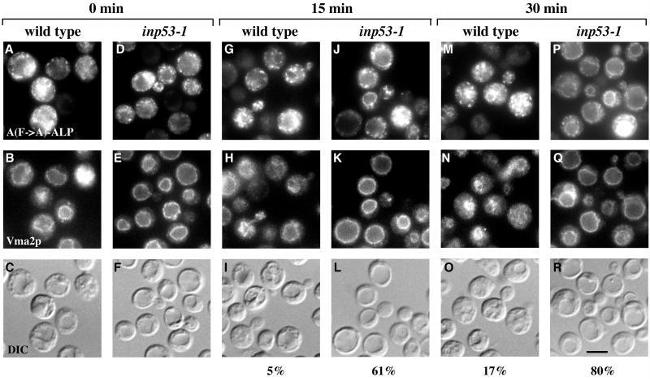 VMA2 Antibody in Immunocytochemistry (ICC/IF)