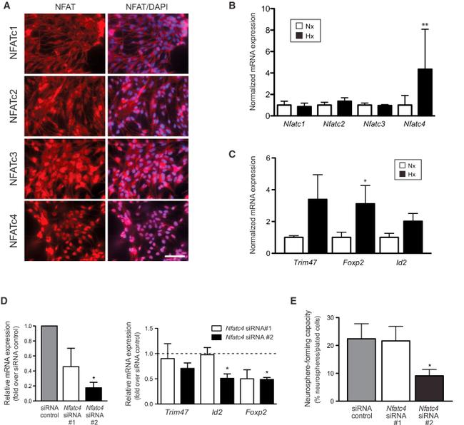 NFATC4 Antibody in Immunocytochemistry (ICC/IF)