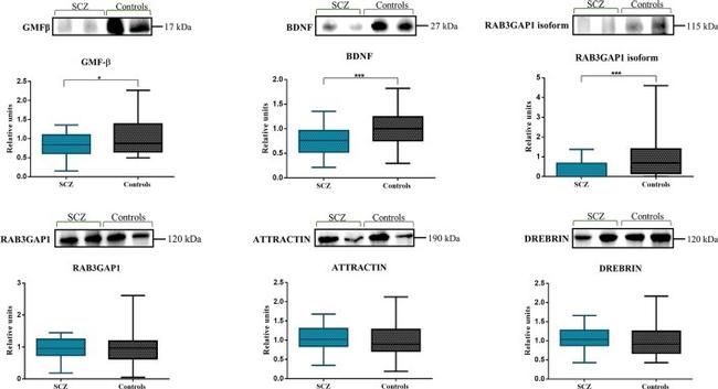 Attractin Antibody in Western Blot (WB)