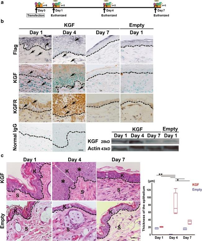 FGFR2 Antibody in Immunohistochemistry (IHC)