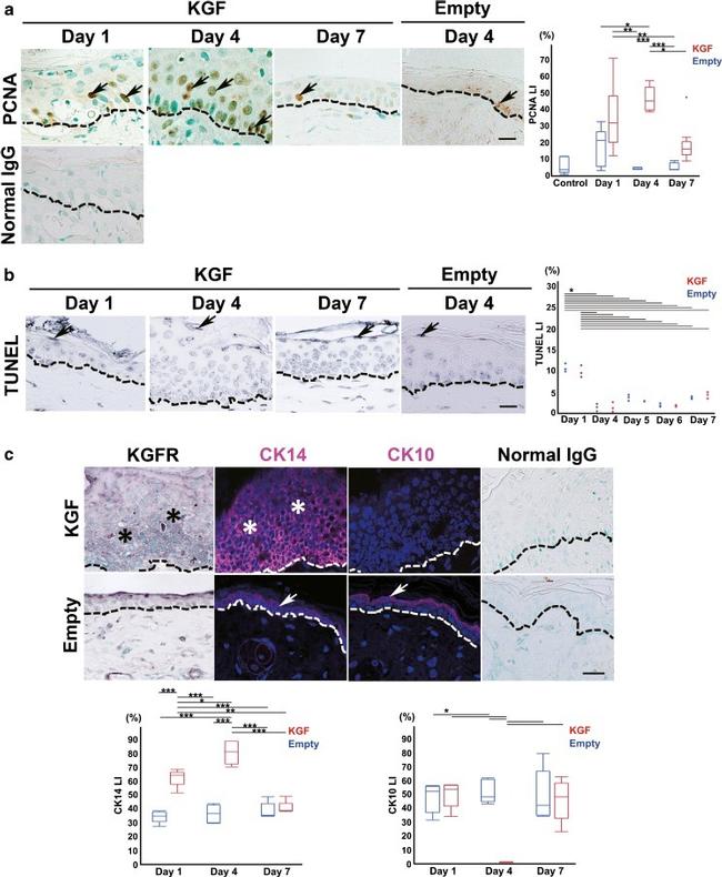 FGFR2 Antibody in Immunohistochemistry (IHC)