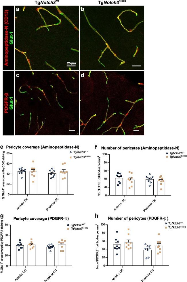 GLUT1 Antibody in Immunohistochemistry (IHC)