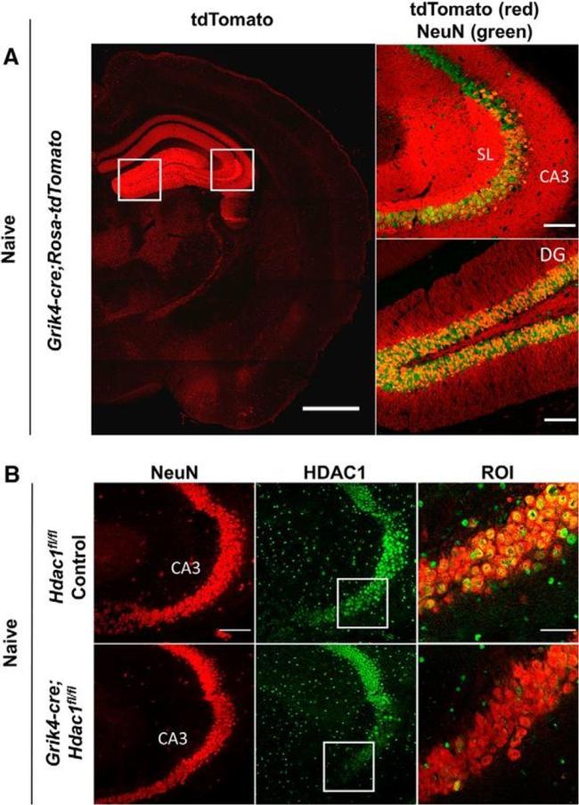 HDAC1 Antibody in Immunohistochemistry (IHC)