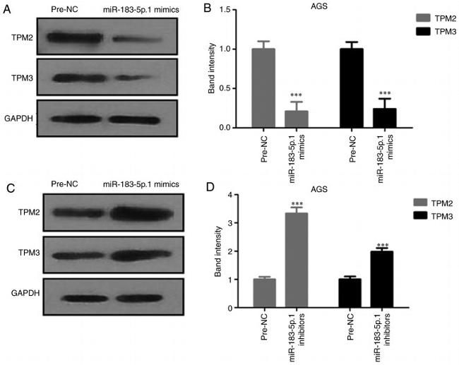 TPM3 Antibody in Western Blot (WB)