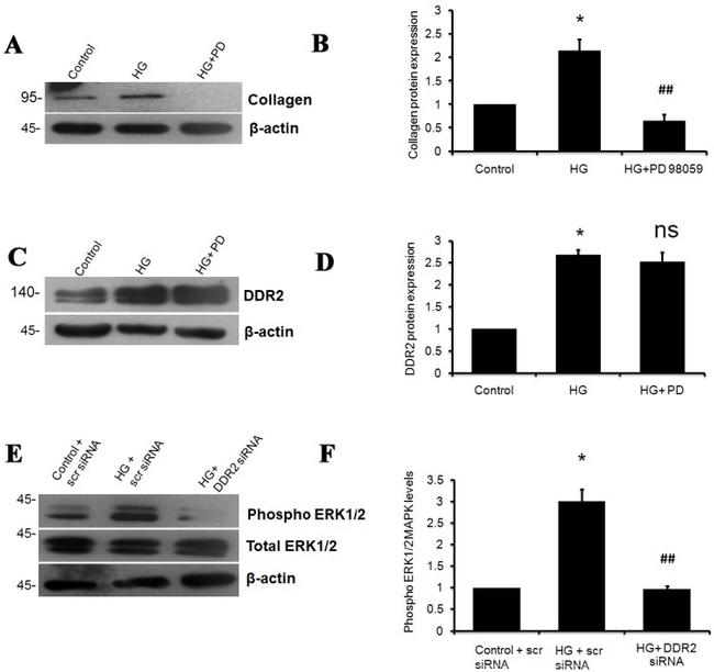 Collagen I Antibody in Western Blot (WB)