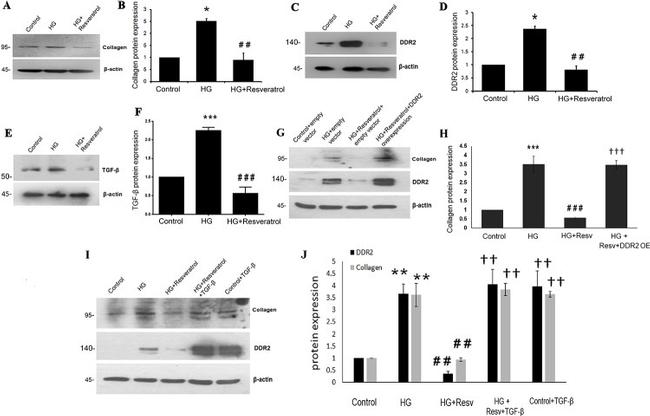 Collagen I Antibody in Western Blot (WB)