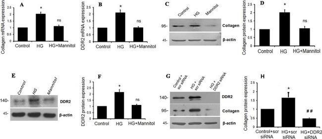 Collagen I Antibody in Western Blot (WB)