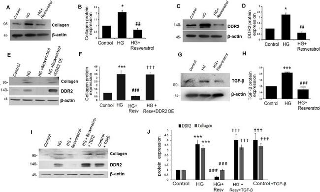 Collagen I Antibody in Western Blot (WB)