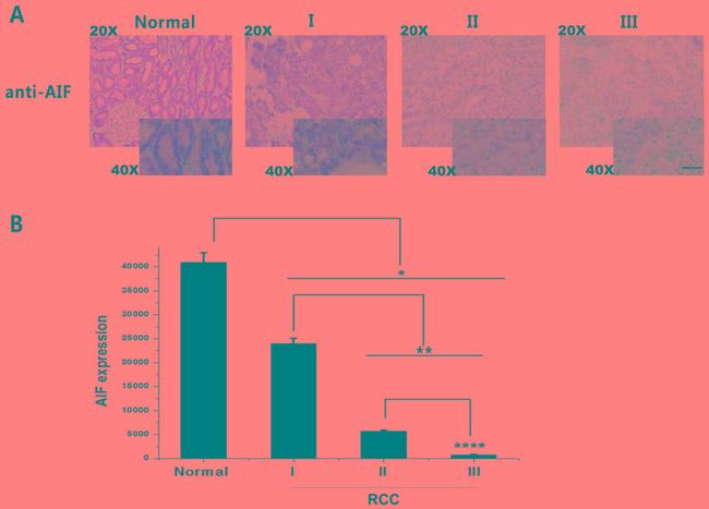 AIF Antibody in Immunohistochemistry (IHC)