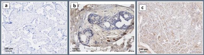 ANGPTL4 Antibody in Immunohistochemistry (IHC)