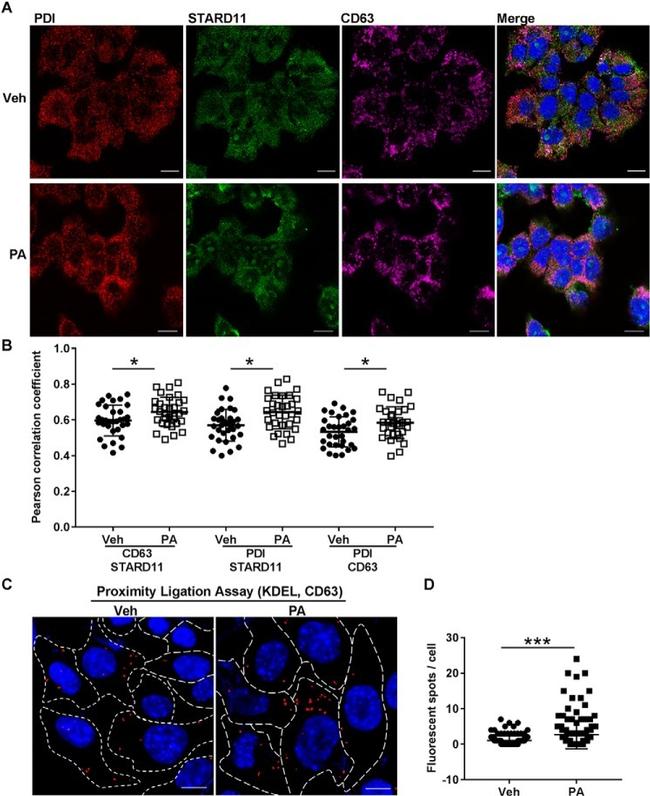 PDI Antibody in Immunocytochemistry (ICC/IF)