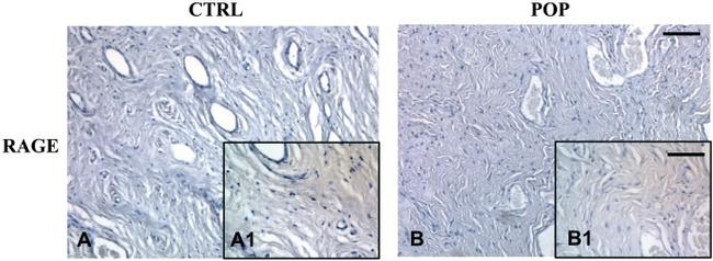 RAGE Antibody in Immunohistochemistry (Paraffin) (IHC (P))