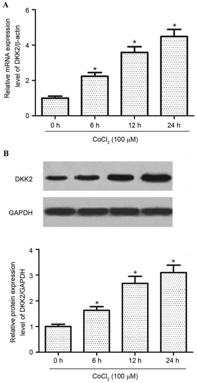 DKK2 Antibody in Western Blot (WB)