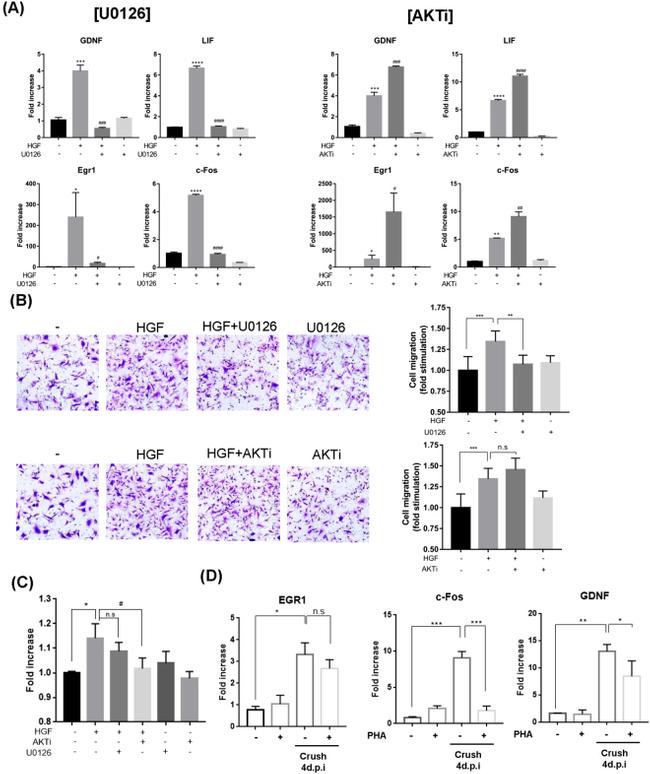 HGF Antibody in Immunohistochemistry (IHC)