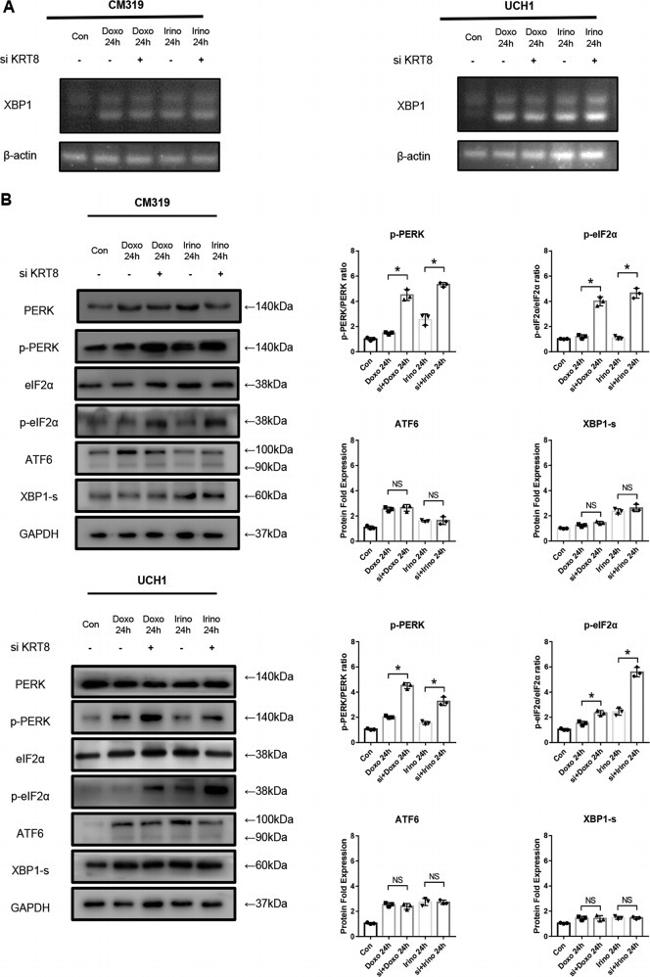 Phospho-PERK (Thr982) Antibody in Western Blot (WB)