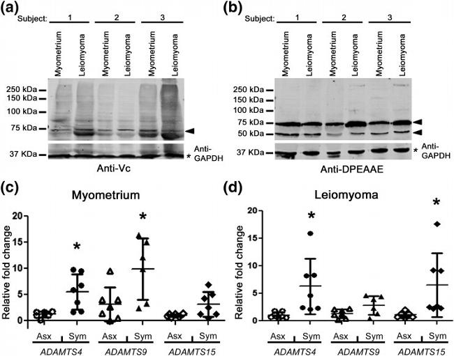 Versican V0, V1 Neo Antibody in Western Blot (WB)