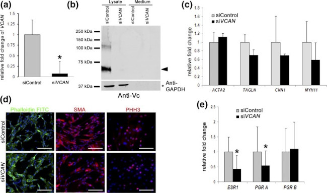 Versican V0, V1 Neo Antibody