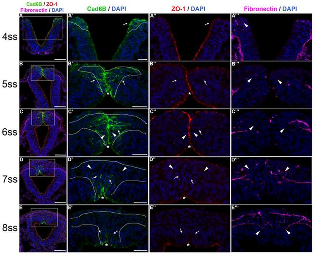 ZO-1 Antibody in Immunocytochemistry, Immunohistochemistry (ICC/IF, IHC)