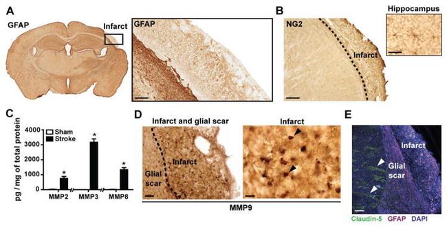 Claudin 5 Antibody in Immunohistochemistry (IHC)