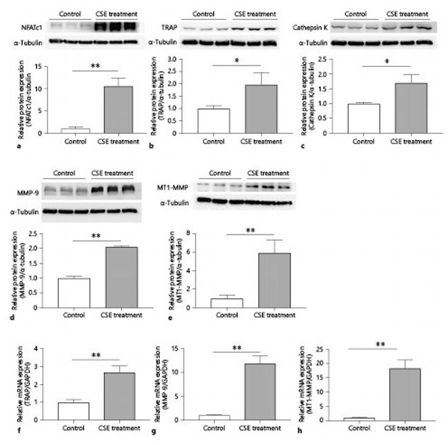 NFATC1 Antibody in Western Blot (WB)