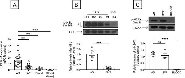 Phospho-HSL (Ser563) Antibody in Western Blot (WB)