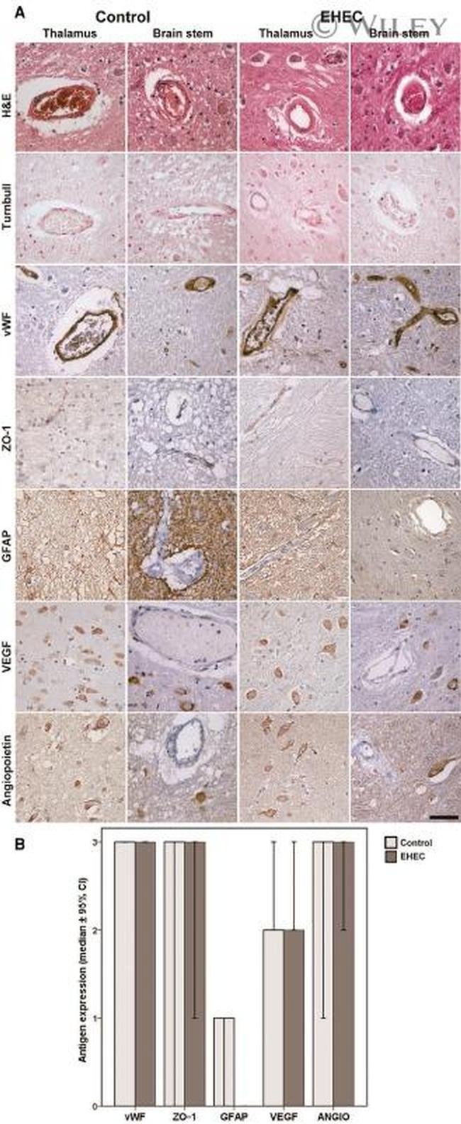 ZO-1 Antibody in Immunohistochemistry (IHC)