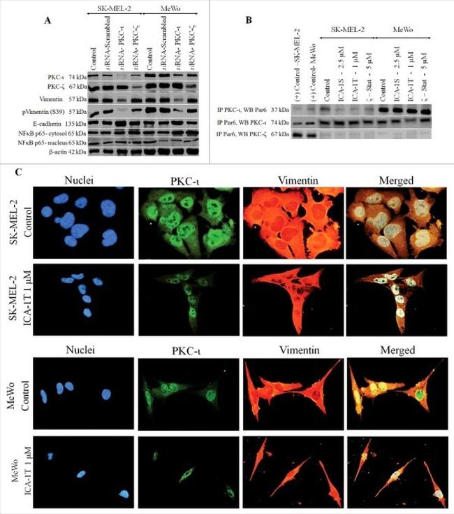 Vimentin Antibody in Western Blot, Immunocytochemistry (WB, ICC/IF)