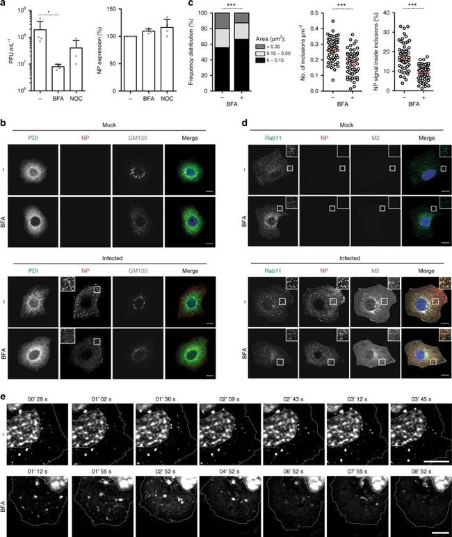 PDI Antibody in Immunocytochemistry (ICC/IF)