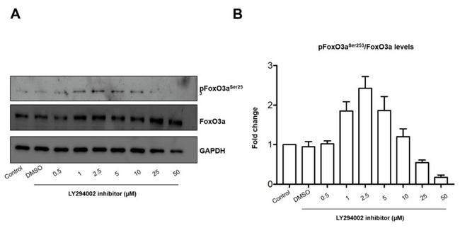 Phospho-FOXO3A (Ser253) Antibody in Western Blot (WB)