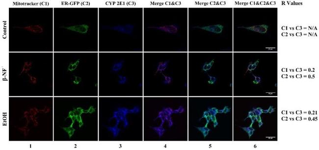 CYP2E1 Antibody in Immunocytochemistry, Immunohistochemistry (ICC/IF, IHC)