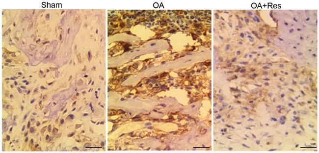 MMP13 Antibody in Immunohistochemistry (IHC)