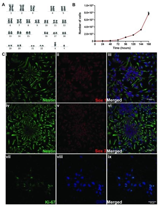 Nestin Antibody in Immunocytochemistry (ICC/IF)