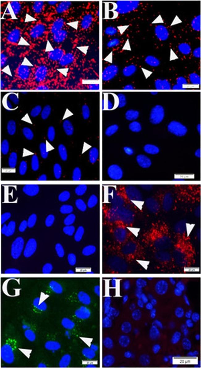 VWF Antibody in Proximity Ligation Assay (PLA) (PLA)