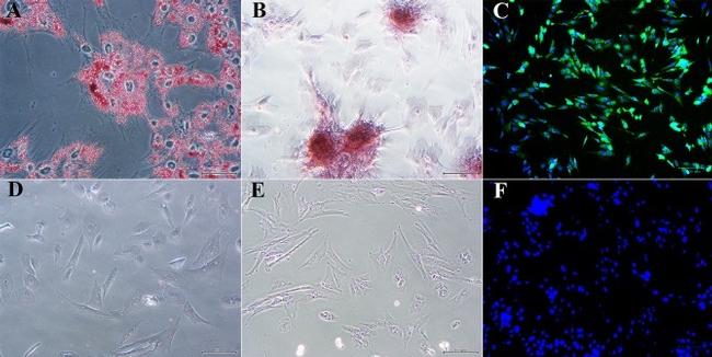 MAP2 Antibody in Immunocytochemistry (ICC/IF)