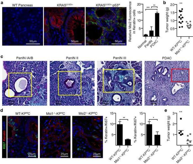 Ki-67 Antibody in Immunohistochemistry, Immunohistochemistry (Paraffin) (IHC, IHC (P))