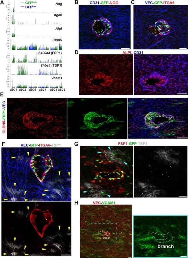 Thrombospondin 1 Antibody in Immunohistochemistry (IHC)