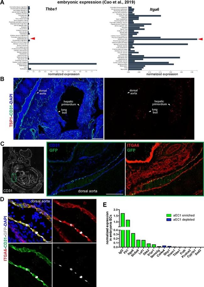 Thrombospondin 1 Antibody in Immunohistochemistry (IHC)