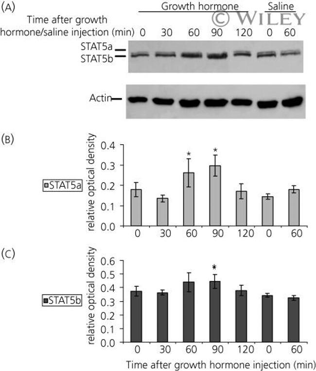 Phospho-STAT5 beta (Tyr694) Antibody in Western Blot (WB)