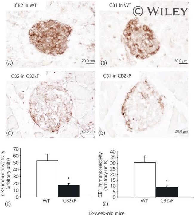 CNR2 Antibody in Immunohistochemistry (IHC)