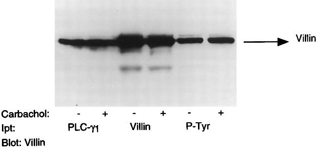 Phosphotyrosine Antibody in Immunoprecipitation (IP)