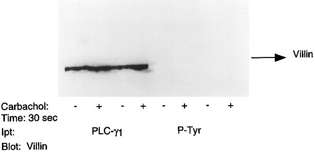 Phosphotyrosine Antibody in Immunoprecipitation (IP)