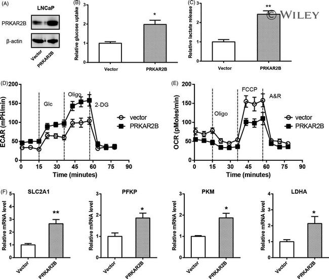 PRKAR2B Antibody in Western Blot (WB)