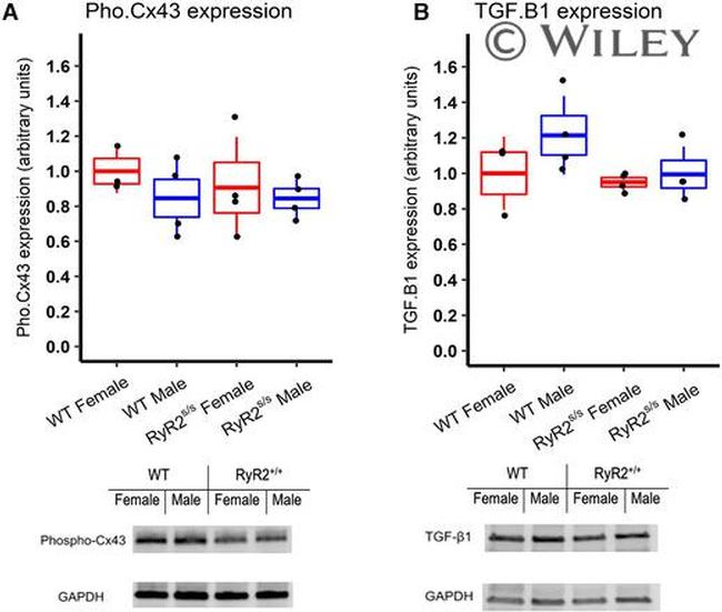 Phospho-Connexin 43 (Ser368) Antibody in Western Blot (WB)