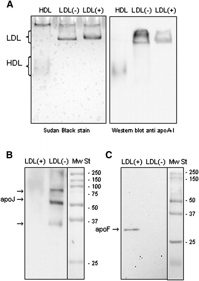 Apolipoprotein J Antibody in Western Blot (WB)