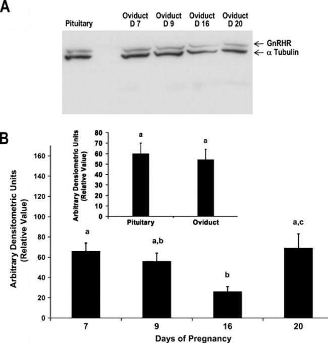 GnRHR Antibody in Western Blot (WB)