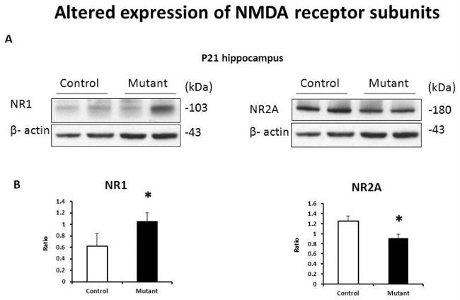 NMDAR1 Antibody in Western Blot (WB)